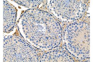 ABIN6260259 and ABIN6276294 at 1/100 staining Mouse testis tissue by IHC-P.
