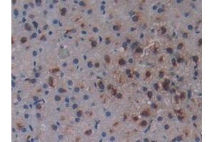 DAB staining on IHC-P; Samples: Rat Adrenal Gland Tissue