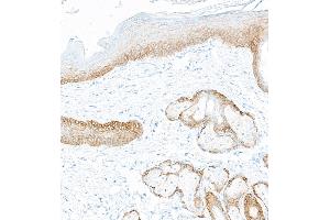 Immunohistochemistry (IHC) image for anti-Keratin 5 (KRT5) (C-Term) antibody (ABIN7795755) (Rekombinanter Cytokeratin 5 Antikörper  (C-Term))