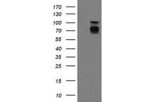 Image no. 6 for anti-Differentially Expressed in FDCP 6 Homolog (DEF6) antibody (ABIN1497808) (DEF6 Antikörper)