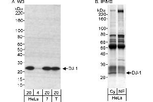 Immunoprecipitation (IP) image for anti-Parkinson Protein 7 (PARK7) (C-Term) antibody (ABIN7454672)