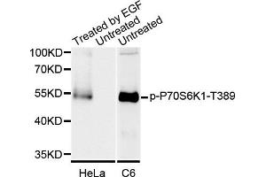 Western blot analysis of extracts of various cell lines, using Phospho-P70S6K1-T389 antibody. (RPS6KB1 Antikörper)