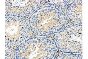 ABIN6258840 and ABIN6276280 at 1/100 staining Mouse testis tissue by IHC-P.
