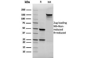 SDS-PAGE Analysis Purified Thyroglobulin Mouse Recombinant Monoclonal Antibody (rTGB24).