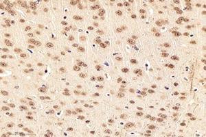 Immunohistochemistry analysis of paraffin-embedded mouse striatumusing,NOS1AP (ABIN7074844) at dilution of 1:4000 (NOS1AP Antikörper)