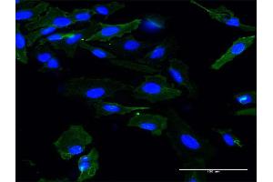 Immunofluorescence of monoclonal antibody to APOM on HeLa cell. (Apolipoprotein M Antikörper  (AA 23-188))