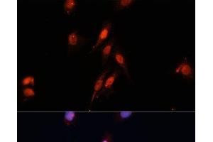 Immunofluorescence analysis of HeLa cells using Smad5 Polyclonal Antibody at dilution of 1:100 (40x lens). (SMAD5 Antikörper)
