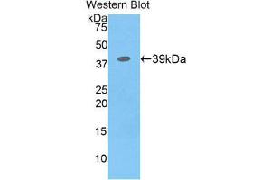 Western Blotting (WB) image for anti-Colony Stimulating Factor 2 Receptor, Beta (CSF2RB) (AA 133-233) antibody (ABIN3206477) (CD131 Antikörper  (AA 133-233))