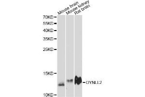 Western blot analysis of extracts of various cell lines, using DYNLL2 antibody (ABIN6292037) at 1:3000 dilution. (DYNLL2 Antikörper)