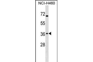 ST6GALNAC4 Antibody (C-term) (ABIN1536802 and ABIN2850365) western blot analysis in NCI- cell line lysates (35 μg/lane).