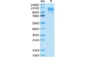 IL31RA Protein (AA 20-519) (His tag)