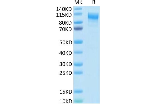 IL31RA Protein (AA 20-519) (His tag)