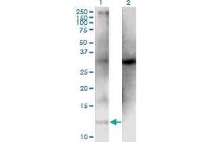 Western Blot analysis of CLPS expression in transfected 293T cell line by CLPS monoclonal antibody (M05), clone 4G3. (CLPS Antikörper  (AA 23-112))