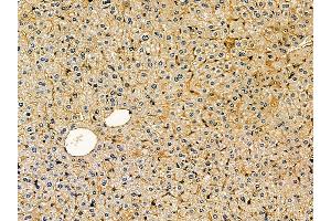 ABIN7095288 and ABIN7099345 at 1/100 staining mouse liver tissue by IHC-P. (SOCS5 Antikörper)