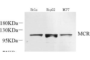 Western Blot analysis of various samples using Mineralocorticoid receptor Polyclonal Antibody at dilution of 1:600. (NR3C2 Antikörper)