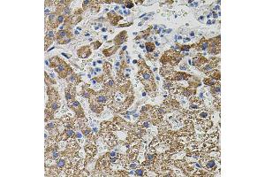 Immunohistochemistry of paraffin-embedded human liver injury using NTF3 antibody (ABIN6290617) (40x lens).