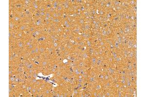 ABIN7094708 and ABIN7098759 at 1/100 staining Rat brain tissue by IHC-P.