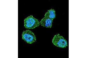 Confocal immunofluorescent analysis of STK11 (LKB1) Antibody (N-term V34) (ABIN391352 and ABIN2841373) with ZR-75-1 cell followed by Alexa Fluor 488-conjugated goat anti-rabbit lgG (green). (LKB1 Antikörper  (N-Term))