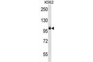Western Blotting (WB) image for anti-PTK2B Protein tyrosine Kinase 2 beta (PTK2B) antibody (ABIN2997867) (PTK2B Antikörper)