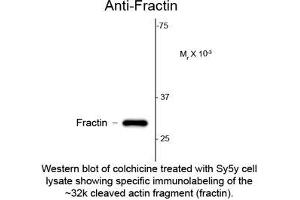 Image no. 1 for anti-Fractin antibody (ABIN959121) (Fractin Antikörper)