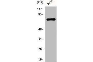 Western Blot analysis of HeLa cells using Phospho-LIMK-1/2 (T508/505) Polyclonal Antibody (LIM Domain Kinase 1/2 (LIMK1/2) (pThr505), (pThr508) Antikörper)