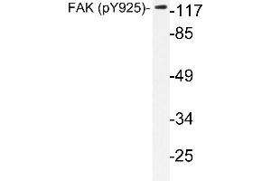Western blot (WB) analyzes of p-FAK antibody in extracts from HepG2 cells. (FAK Antikörper  (pTyr925))