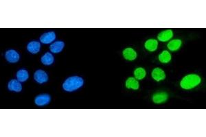 IF analysis of SPHK1 using anti-SPHK1 antibody (ABIN7600168). (SPHK1 Antikörper  (AA 16-267))