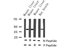 Western Blotting (WB) image for anti-cAMP Responsive Element Binding Protein 1 (CREB1) (pSer133) antibody (ABIN6256130)
