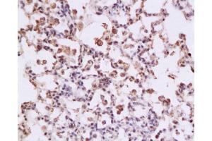 Immunohistochemistry (Paraffin-embedded Sections) (IHC (p)) image for anti-Signal Transducer and Activator of Transcription 3 (Acute-Phase Response Factor) (STAT3) (AA 233-330) antibody (ABIN738261)