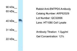 Western Blotting (WB) image for anti-Ectonucleoside Triphosphate diphosphohydrolase 5 (ENTPD5) (N-Term) antibody (ABIN2788995) (ENTPD5 Antikörper  (N-Term))