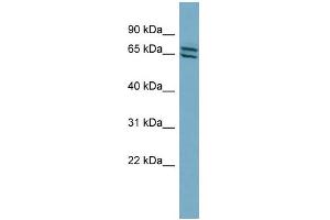 WB Suggested Anti-PDE1C Antibody Titration: 0. (PDE1C Antikörper  (Middle Region))