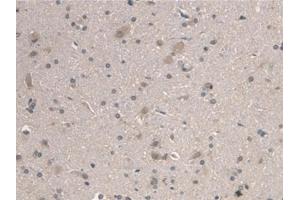 Immunohistochemistry (IHC) image for anti-Aryl Hydrocarbon Receptor Nuclear Translocator-Like (ARNTL) (AA 1-169) antibody (ABIN7435529)