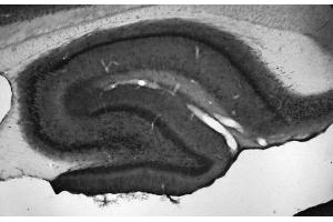 Adult rat hippocampus immunohistochemistry.