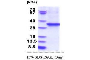 EEF2 Protein (AA 574-858) (His tag)
