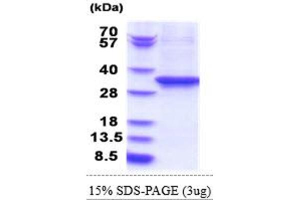 EEF2 Protein (AA 574-858) (His tag)