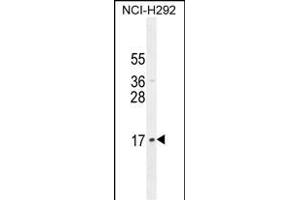 LLPH Antibody (Center) (ABIN654797 and ABIN2844474) western blot analysis in NCI- cell line lysates (35 μg/lane).