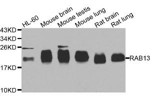 Western blot analysis of extracts of various cell lines, using RAB31 antibody. (RAB31 Antikörper)