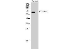 Western Blotting (WB) image for anti-CstF-64T (Internal Region) antibody (ABIN3180563) (CstF-64T (Internal Region) Antikörper)