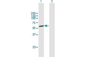Western Blot analysis of PICK1 expression in transfected 293T cell line by PICK1 MaxPab polyclonal antibody. (PICK1 Antikörper  (AA 1-415))