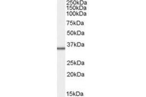 Image no. 1 for anti-Mitochondrial Ribosomal Protein L3 (MRPL3) (C-Term) antibody (ABIN374279) (MRPL3 Antikörper  (C-Term))