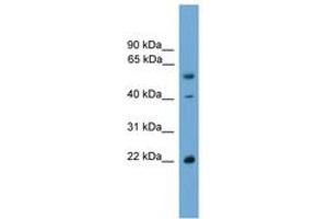 Image no. 1 for anti-WW Domain Binding Protein 4 (WBP4) (AA 35-84) antibody (ABIN6744958) (WBP4 Antikörper  (AA 35-84))
