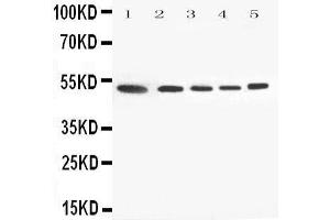Western Blotting (WB) image for anti-Annexin A7 (ANXA7) (AA 445-460), (C-Term) antibody (ABIN3044073) (Annexin VII Antikörper  (C-Term))