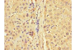 Immunohistochemistry of paraffin-embedded human liver tissue using ABIN7153605 at dilution of 1:100