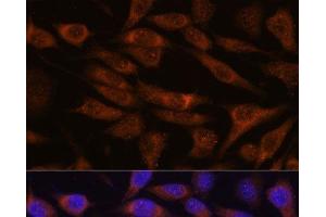 Immunofluorescence analysis of L929 cells using UNC13B Polyclonal Antibody at dilution of 1:100. (UNC13B Antikörper)