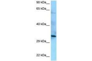 Image no. 1 for anti-Protein Phosphatase 6, Catalytic Subunit (PPP6C) (AA 90-139) antibody (ABIN6748166) (PPP6C Antikörper  (AA 90-139))