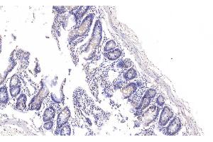 Immunohistochemistry (IHC) image for anti-R-Spondin 1 (RSPO1) (AA 136-262) antibody (ABIN7437200)