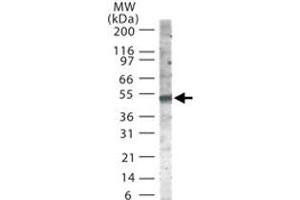 Western blot analysis of SMAD6 in 30 ug of Jurkat cell lysate using SMAD6 polyclonal antibody  at 2 ug/mL . (SMAD6 Antikörper  (AA 85-99))