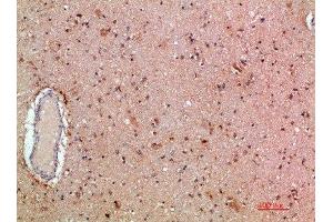 Immunohistochemical analysis of paraffin-embedded human-brain, antibody was diluted at 1:200 (MLL/KMT2A Antikörper  (AA 3850-3900))