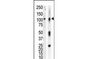 Western blot analysis of anti-PKCnu Pab in lysate of HL60 cells stimulated with PMA (lane A) and mouse brain tissue lysate (lane B) (PRKD3 Antikörper  (AA 352-384))