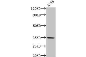 Western Blot Positive WB detected in: A375 whole cell lysate All lanes: MC1R antibody at 4 μg/mL Secondary Goat polyclonal to rabbit IgG at 1/50000 dilution Predicted band size: 35 kDa Observed band size: 35 kDa (MC1 Receptor Antikörper  (AA 1-37))